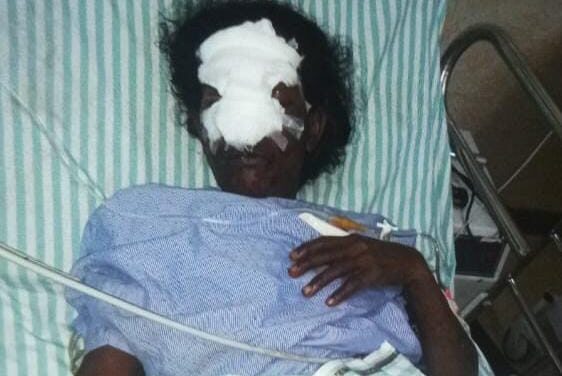 ಹೂ ಕಿತ್ತಿದ್ದಕ್ಕೆ ಮಹಿಳಿಯ ಮೂಗನ್ನೇ ಕತ್ತರಿಸಿದ ದುರುಳರು