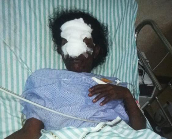 ಹೂ ಕಿತ್ತಿದ್ದಕ್ಕೆ ಮಹಿಳಿಯ ಮೂಗನ್ನೇ ಕತ್ತರಿಸಿದ ದುರುಳರು