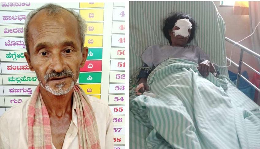 ಮಹಿಳೆಯ ಮೂಗು ಕತ್ತರಿಸಿದ್ದ ಆರೋಪಿ ಬಂಧನ