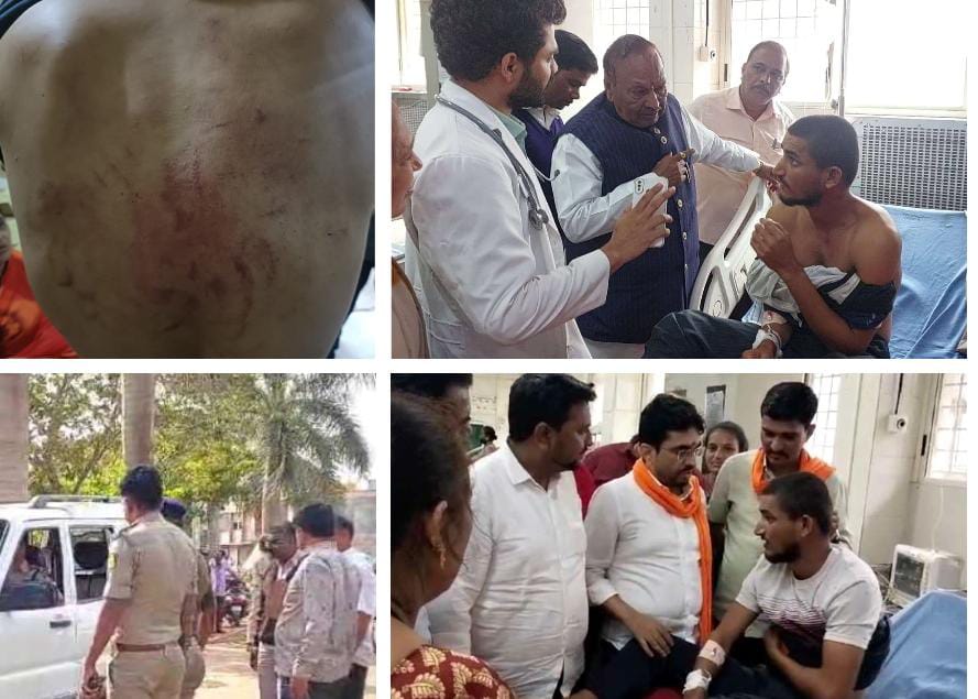 ನಾವು ಅಕ್ಕಾ, ತಮ್ಮ ಅದೀವಿ ಬಿಡ್ರಿ ಎಂದರು ಬಿಡದೆ ಹೊಡೆದ ಪುಂಡರು ; ಏಳು ಜನರ ಬಂಧನ