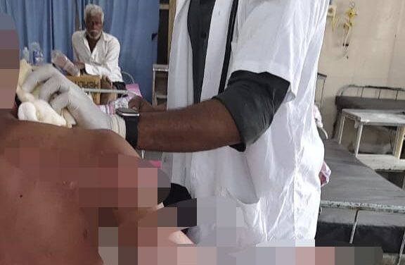 ಉಗಾರ ಸಕ್ಕರೆ ಕಾರ್ಖಾನೆಯಲ್ಲಿ ಅಗ್ನಿ ಅವಘಡ ; ಕಾರ್ಮಿಕನಿಗೆ ಗಂಭೀರ ಗಾಯ