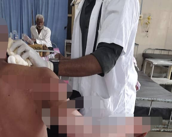 ಉಗಾರ ಸಕ್ಕರೆ ಕಾರ್ಖಾನೆಯಲ್ಲಿ ಅಗ್ನಿ ಅವಘಡ ; ಕಾರ್ಮಿಕನಿಗೆ ಗಂಭೀರ ಗಾಯ