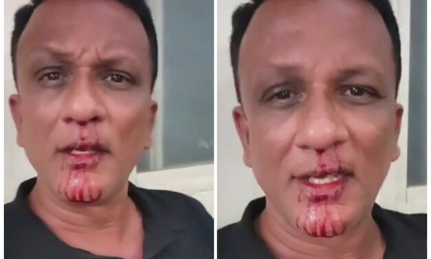 ಲಾಯರ್ ಜಗದೀಶ್ ಮೇಲೆ ಹಲ್ಲೆ ; ಮೂಗಲ್ಲಿ ಸುರಿದ ರಕ್ತ