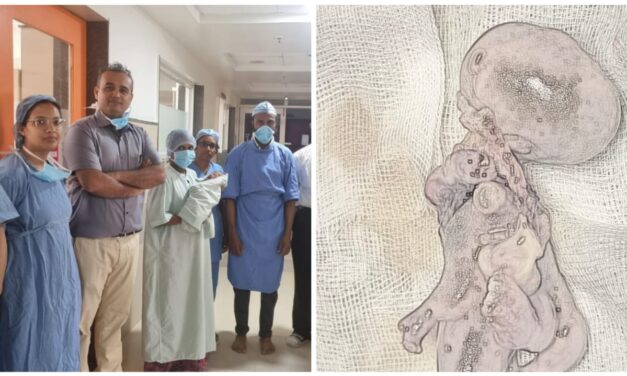 ಶಿಶು ಹೊಟ್ಟೆಯಲ್ಲಿ ಭ್ರೂಣ ; ಕೆಎಲ್ಇ ವೈದ್ಯರಿಂದ ಯಶಸ್ವಿ ಶಸ್ತ್ರಚಿಕಿತ್ಸೆ