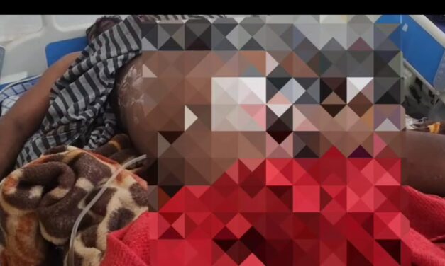 ತನ್ನದೇ ಮರ್ಮಾಂಗ ಕಲ್ಲಿನಿಂದ ಜಜ್ಜಿಕೊಂಡು ಆಸ್ಪತ್ರೆ ಸೇರಿದ ಭೂಪ